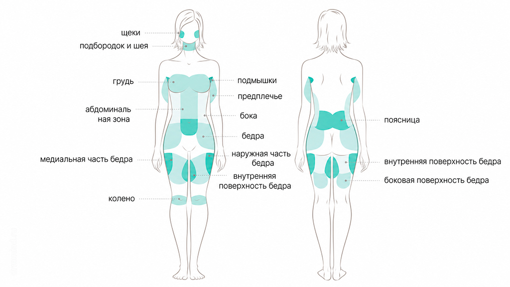 проблемные зоны
